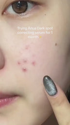 Anua - Niacinamide 10 + TXA 4 Serum