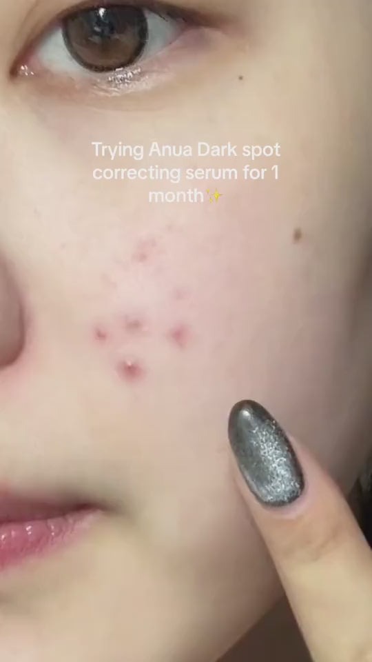 Anua - Niacinamide 10 + TXA 4 Serum